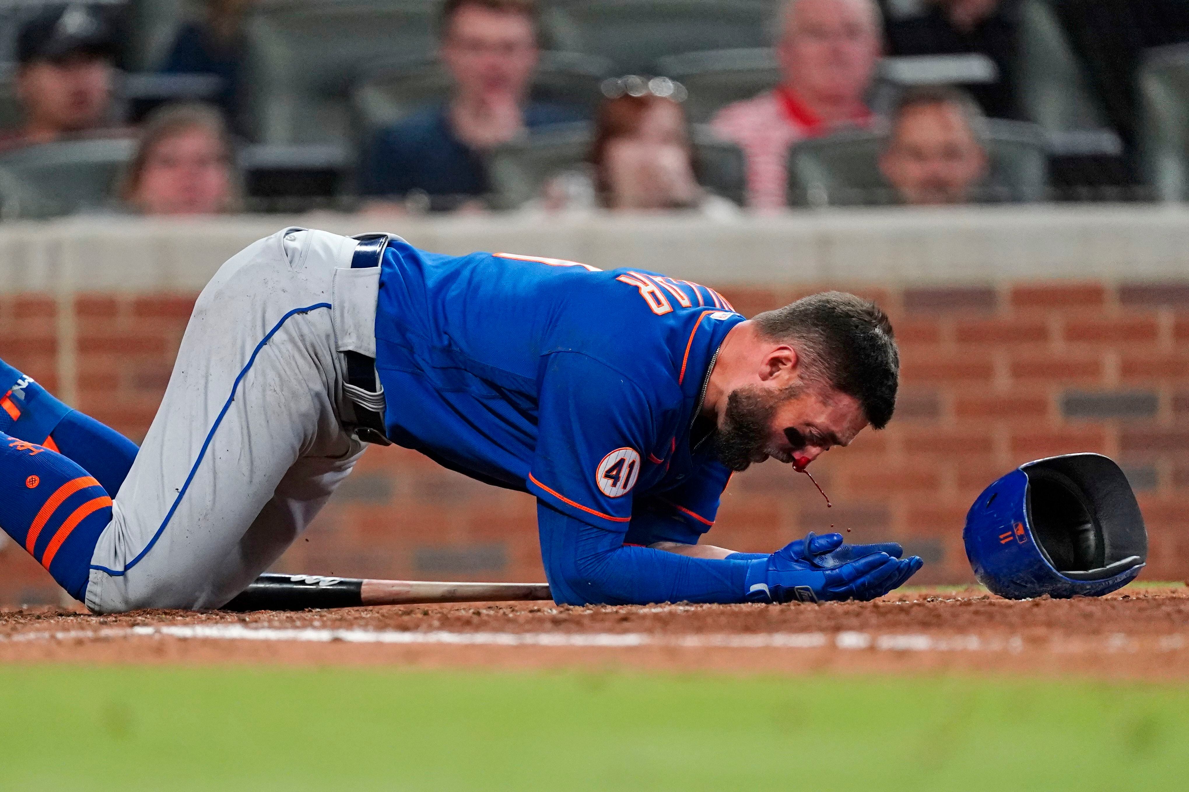 Kevin Pillar injury update: Mets OF suffered multiple nasal fractures